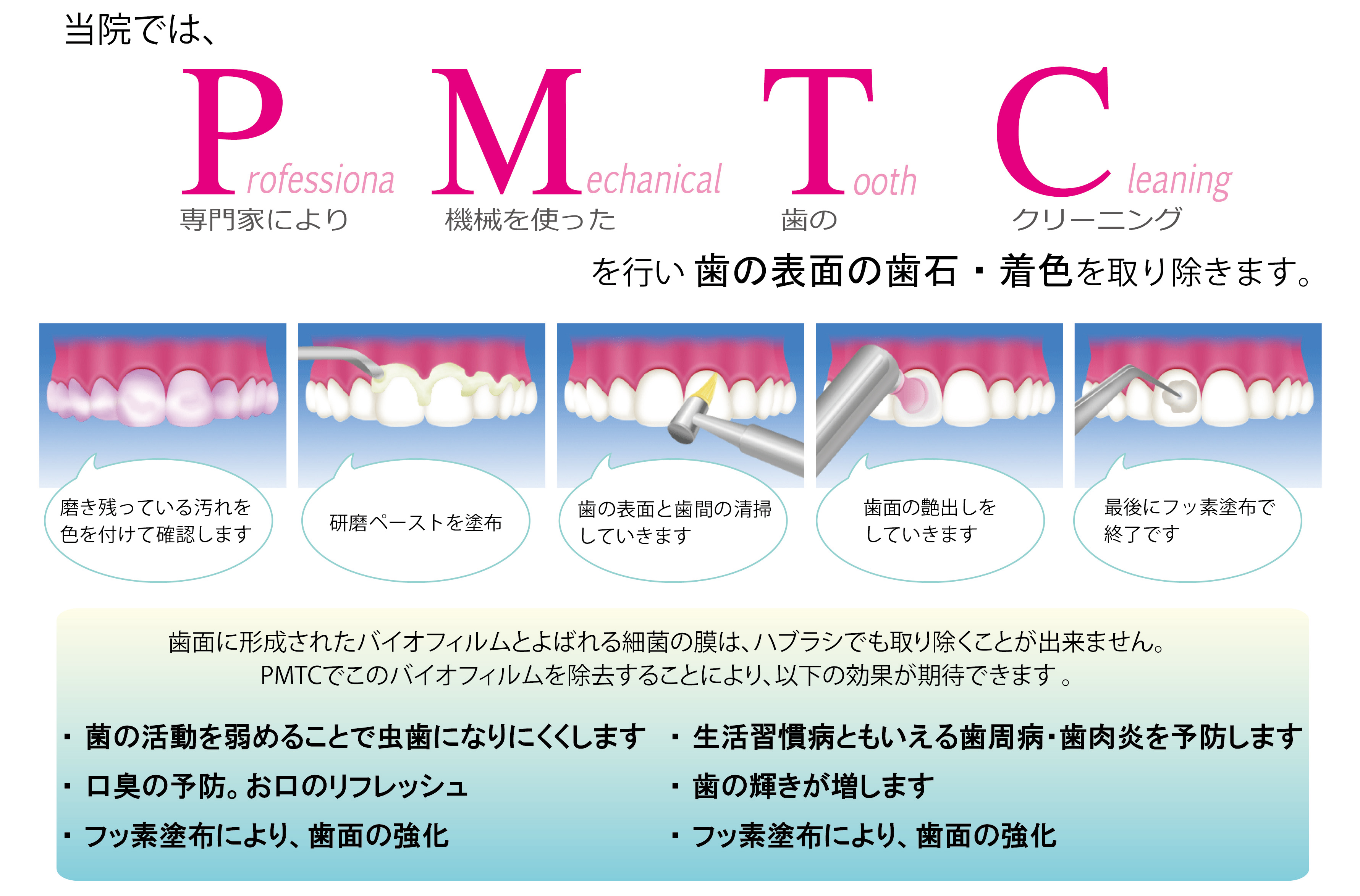 歯 の クリーニング pmtc 料金